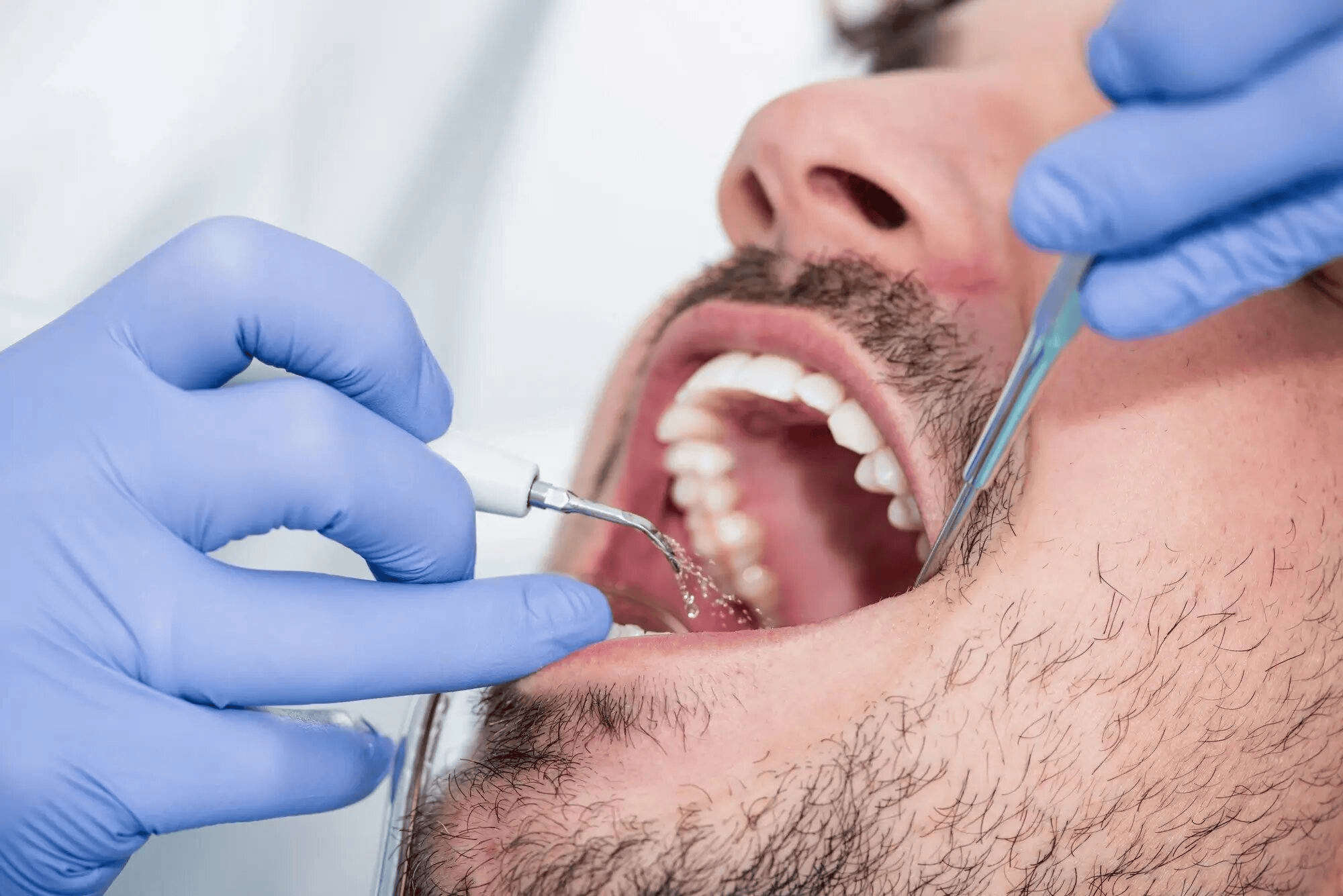 man-getting-Cincinnati-dental-cleaning